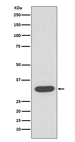CDK4 Rabbit mAb