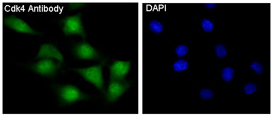 CDK4 Rabbit mAb