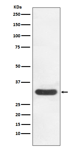 CDK4 Rabbit mAb