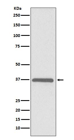 ERCC1 Rabbit mAb