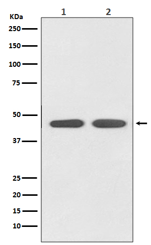 AGTR1 Rabbit mAb 