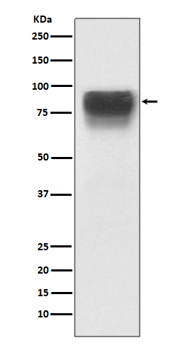 TGN46 Rabbit mAb