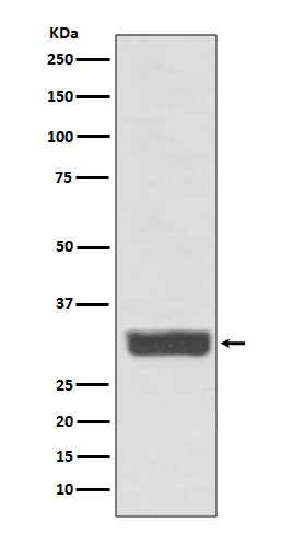 Galectin 3 Rabbit mAb
