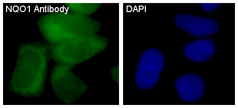 NQO1 Rabbit mAb