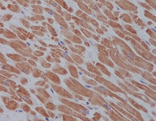 ULK1 Rabbit mAb