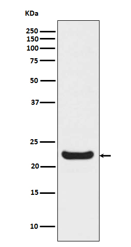 RBP4 Rabbit mAb