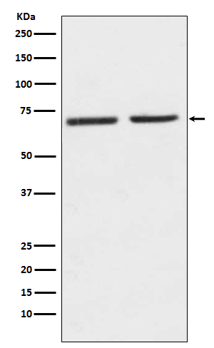 5HT2C Receptor Rabbit mAb