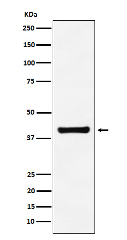 Aldolase Rabbit mAb
