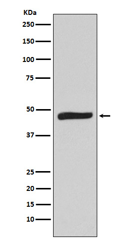 MAPKAP Kinase 2 Rabbit mAb