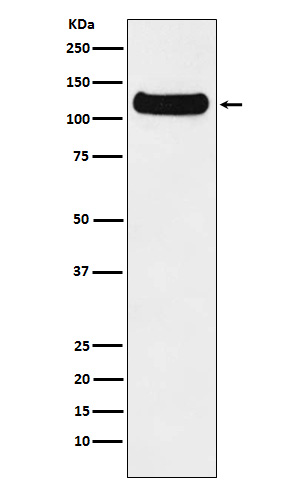 DDB1 Rabbit mAb