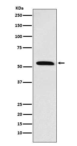 Retinoid X Receptor alpha Rabbit mAb