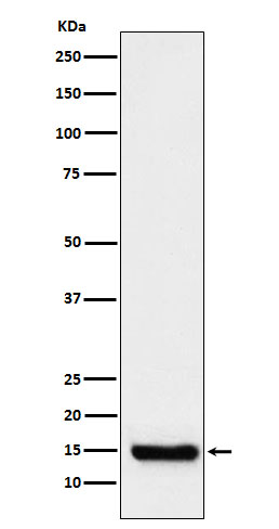 TTC11 Rabbit mAb