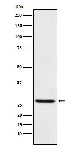 EIF4E Rabbit mAb