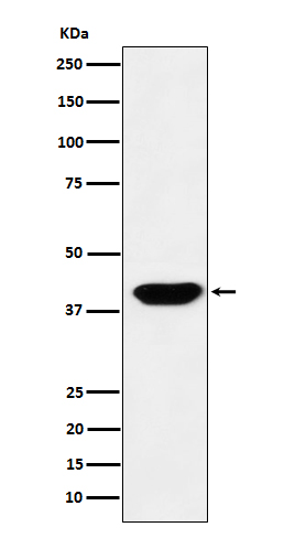 Islet1 Rabbit mAb