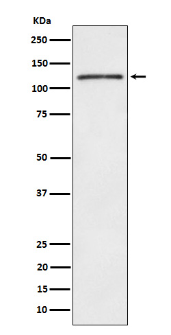 FYB Rabbit mAb