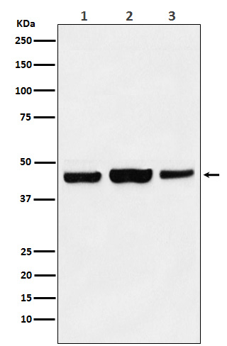 KAT1 / HAT1 Rabbit mAb