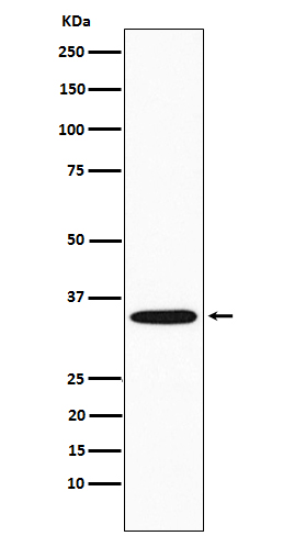 GNB2 Rabbit mAb