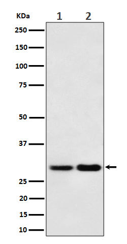 MTAP Rabbit mAb