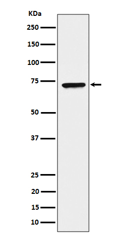 CTP synthase / CTPS Rabbit mAb