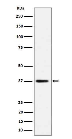 MRPS31 Rabbit mAb