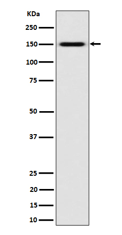 SLC12A1 / NKCC2 Rabbit mAb