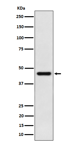 ACAT1 Rabbit mAb