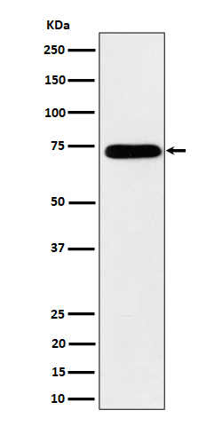 HNRNPM Rabbit mAb