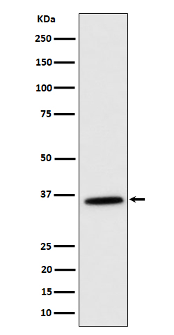 MDH2 Rabbit mAb