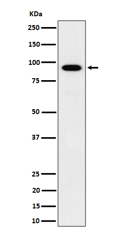IFT88 Rabbit mAb