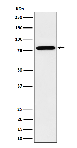 PRMT7 Rabbit mAb