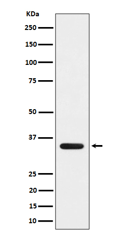 MLD Rabbit mAb