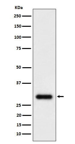 TMEM192 Rabbit mAb