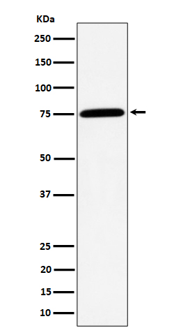 PPM1G Rabbit mAb