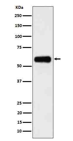 CD116 Rabbit mAb