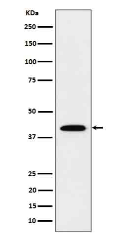 IL12B Rabbit mAb