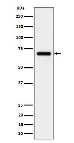 CD125 Rabbit mAb