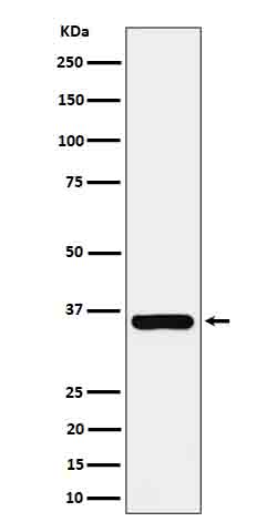 Gamma glutamyl hydrolase Rabbit mAb