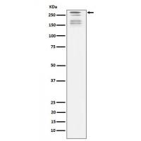 ARID1A Rabbit mAb