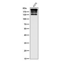 ARID1A Rabbit mAb