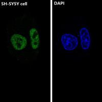 ARID1A Rabbit mAb