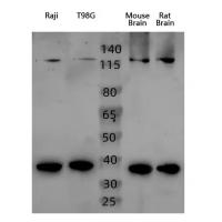 ADCY3 Antibody