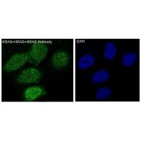 KRAS+HRAS+NRAS Rabbit mAb 