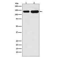 K Cadherin Rabbit mAb