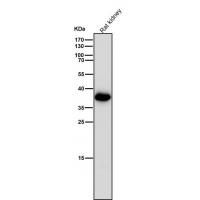 AKR1C3 Rabbit mAb