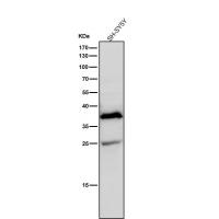 AKR1C3 Rabbit mAb