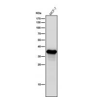 AKR1C3 Rabbit mAb