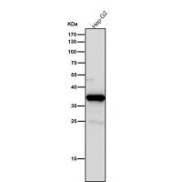 AKR1C3 Rabbit mAb