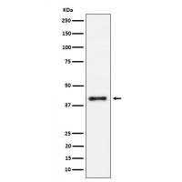 IL15RA Rabbit mAb