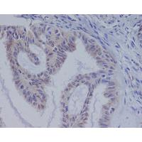 B Raf Rabbit mAb