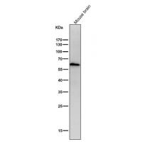 ELK1 Rabbit mAb